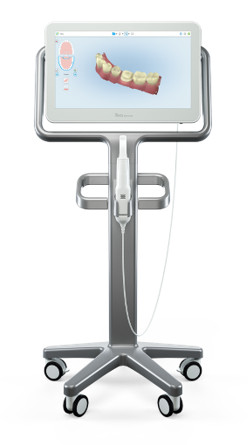 itero scanner